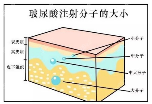 <!--<i data=20240705-sp></i>-->整形秦琴医生注射玻尿酸技术娴熟