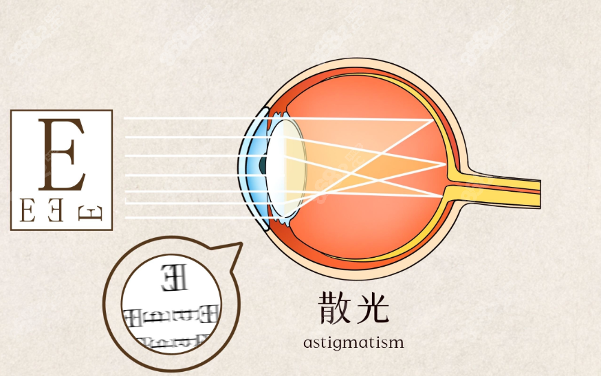 西安眼科排名前十医院