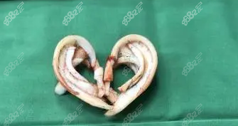 西安耳朵整形醫(yī)院排名