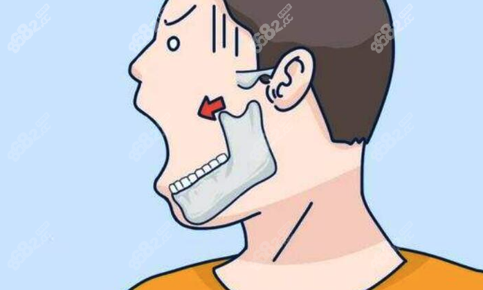 颌面磨骨手术到底值不值得做