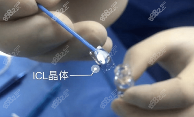 兰州华厦眼科医院icl晶体植入近视手术价格