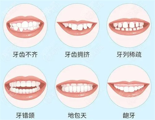 <!--<i data=20240705-sp></i>-->口腔牙齿矫正技术高超
