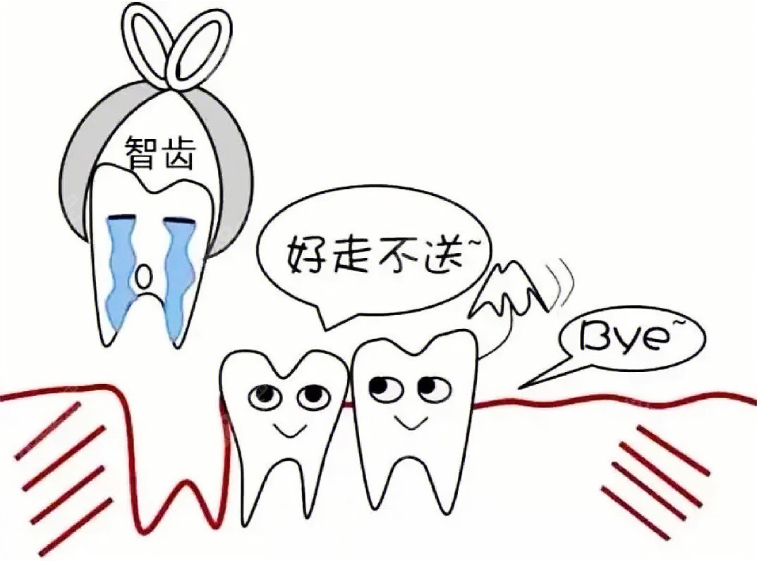 拔智齿