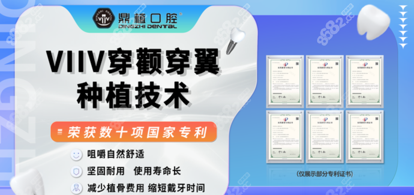 上海鼎植口腔种植 上海鼎植口腔种植