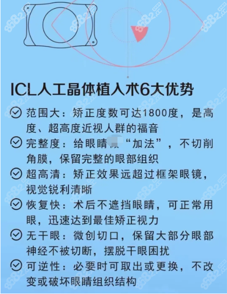 未满18岁或年龄超过45岁的人不适合icl晶体植入