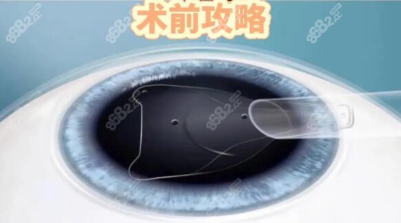 我国做近视眼手术好的医院有哪些？