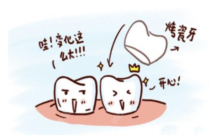 烤瓷牙确实可以修复牙齿外形