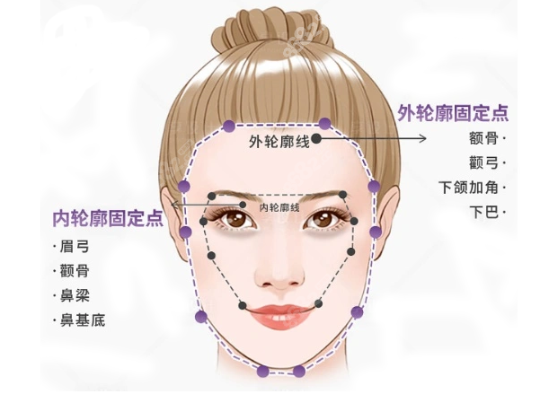 上海輪廓固定哪個(gè)醫(yī)生做的好