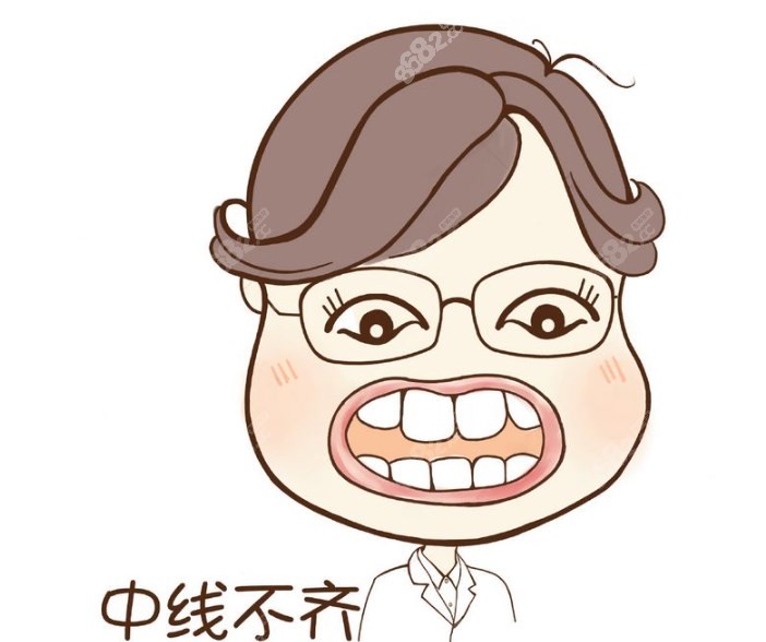 上海徐汇区正畸不贵