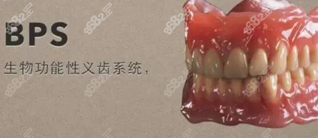 半口牙可以做吸附性义齿-8682网站