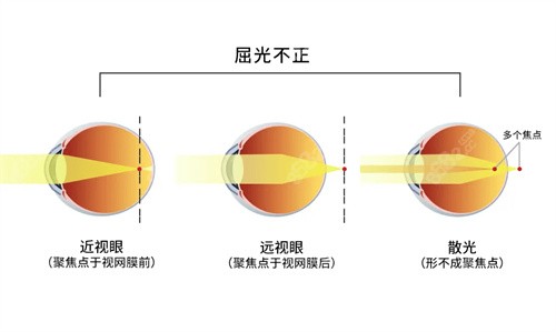 广州英华眼科医院正规吗