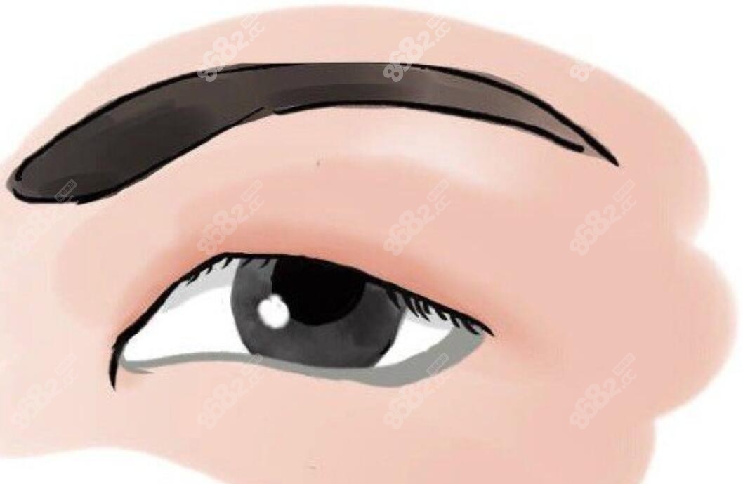 杜园园修复眼睛好