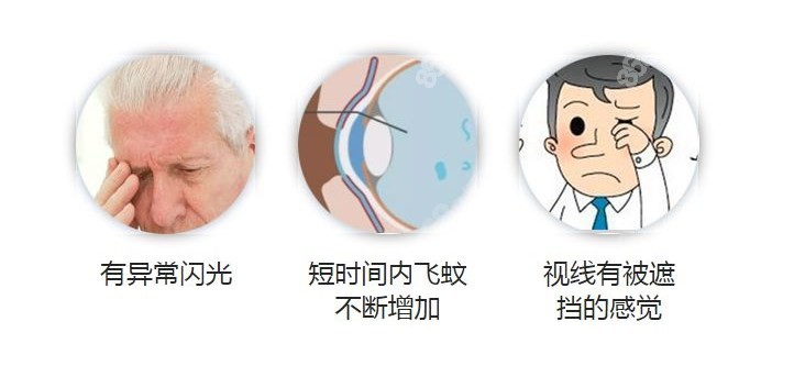 飞蚊症