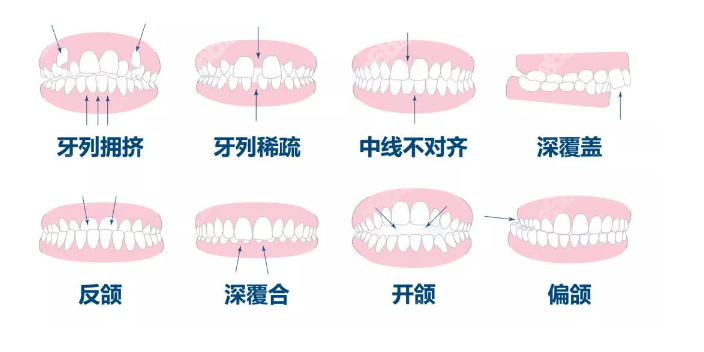 东莞虎门牙齿矫正价格约6500元起