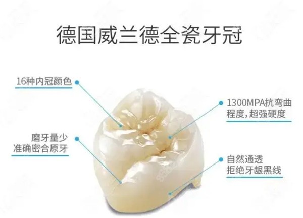 全瓷牙选哪个