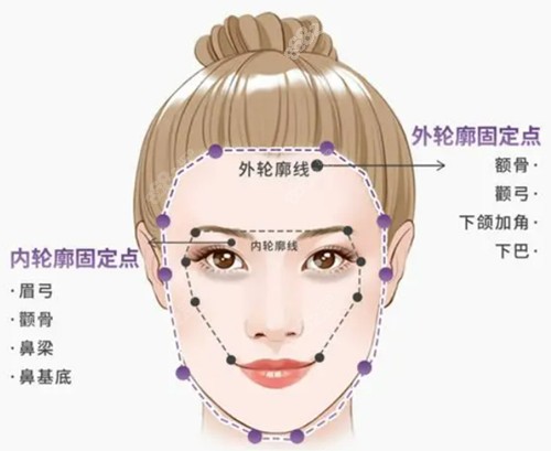 北京轮廓固定医院哪家好？