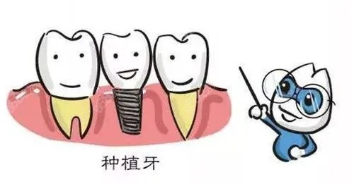 重庆亿佰口腔医院种植牙多少钱一颗？