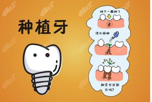 重庆亿佰口腔医院荆建忠医生种牙技术优势