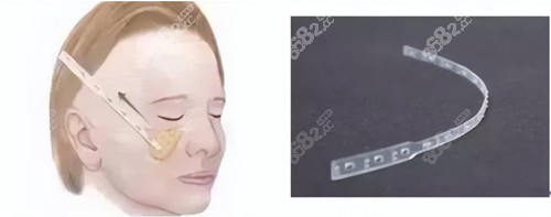 <!--<i data=20240705-sp></i>-->刘德东做微拉美怎么样