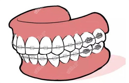 广州壹加壹口腔牙齿矫正价格