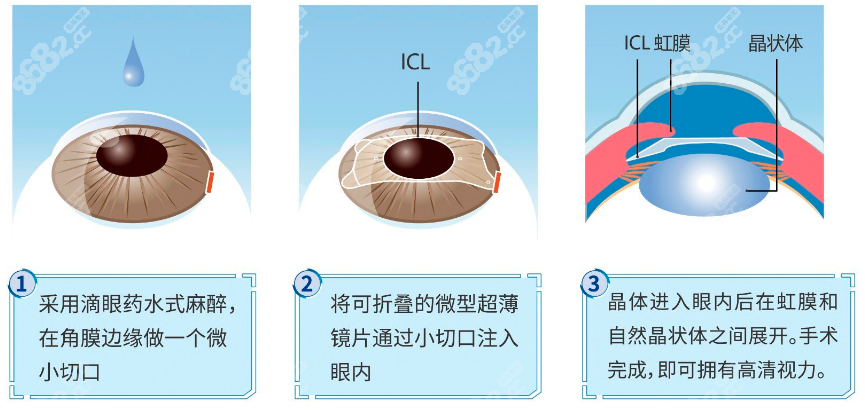 西安眼科好的医院排名前十