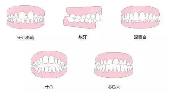 贵阳德韩口腔种植牙多少钱www.8682.cc