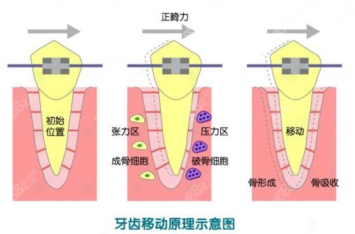 深圳光明区牙齿矫正哪家医院比较好