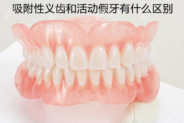 吸附性义齿和活动义齿的优缺点