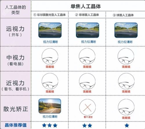 德国蔡司单焦人工晶体价格单