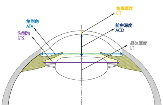 进口人工晶体和国产人工晶体区别