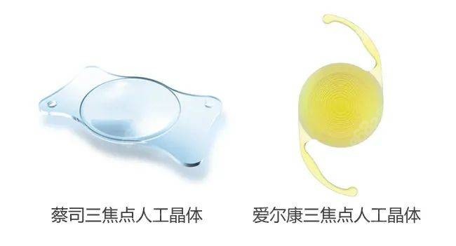 2023白内障进口人工晶体价格表
