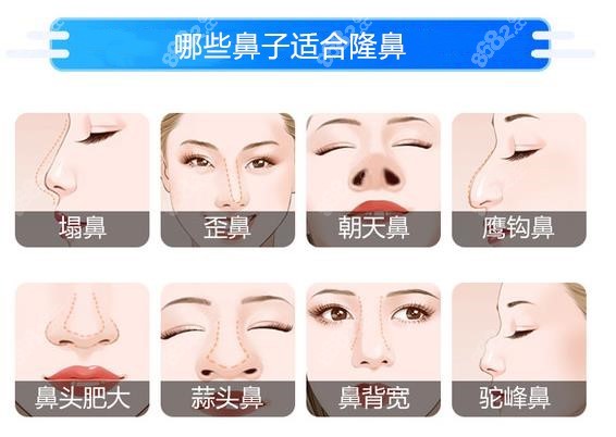 义乌艺星整形医院隆鼻多少钱 8682网