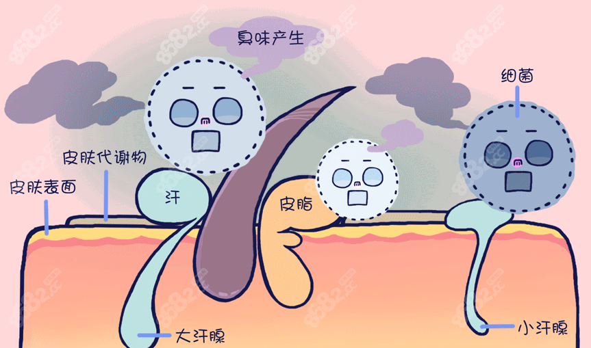 杭州手术去腋臭价格多少钱