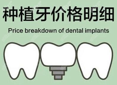 柳州华喜口腔种植牙补贴价明细