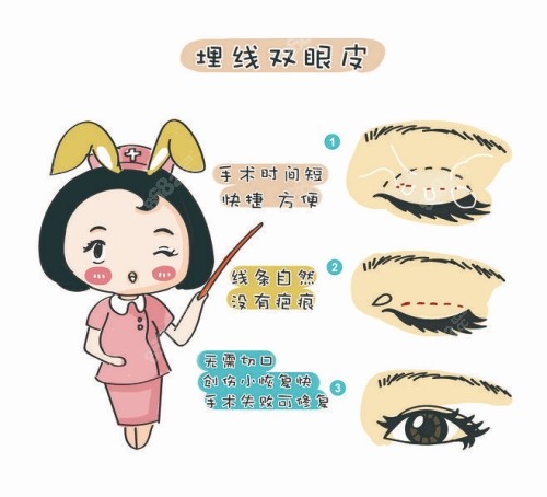 眼睛技术特色