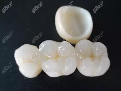 单个烤瓷牙www.8682.cc