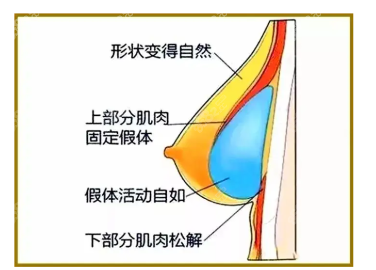 上海朴光哲隆胸价格表