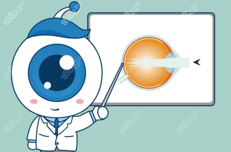 这是近视眼手术卡通图