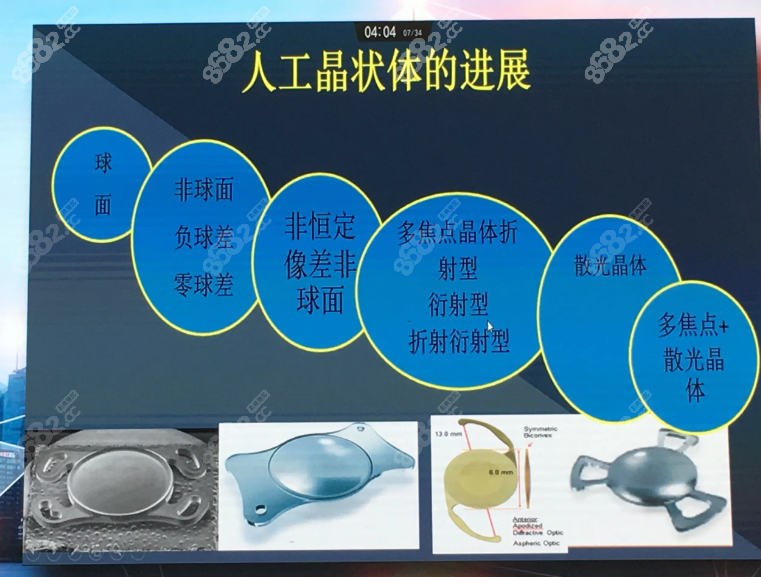 西安凌度眼科医院价格表~青光眼手术费用