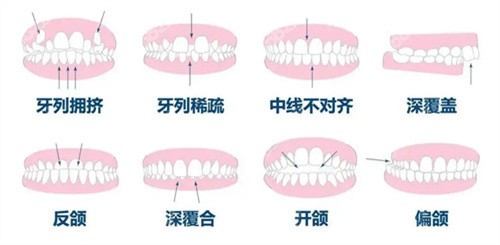 <!--<i data=20240705-sp></i>-->口腔医院正畸医生推荐——赵旭峰