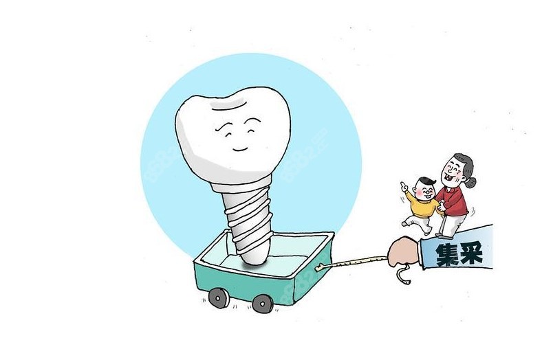 皓圣种植牙集采