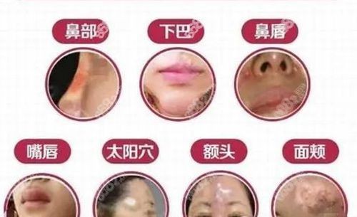 广州荔湾区<!--<i data=20240705-sp></i>-->清奥收费m.8682.cc