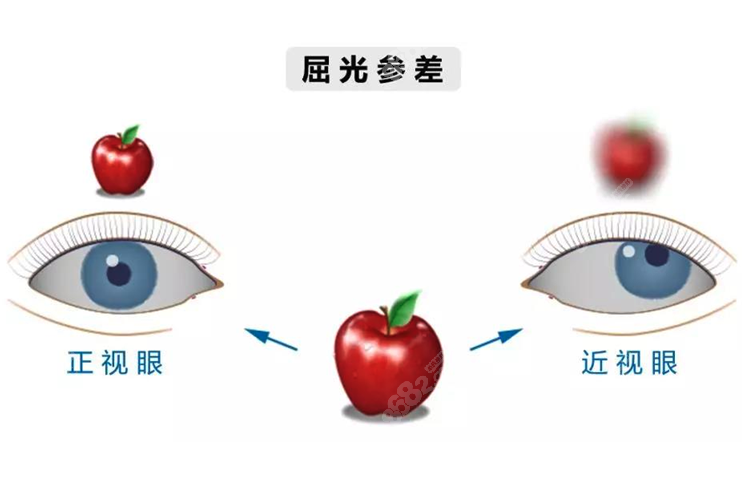 上海爱尔眼科