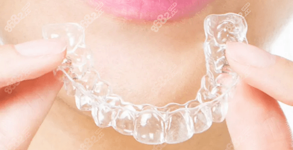 隐形矫正 隐形矫正