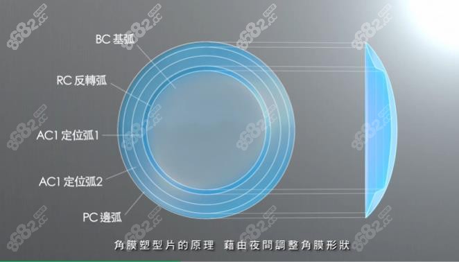 国产亨泰角膜塑形镜优缺点8682.cc