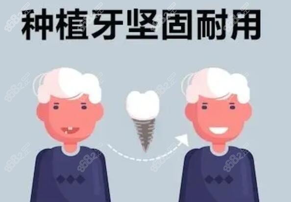 全口种植牙坚固耐用www.8682.cc 全口种植牙坚固耐用www.8682.cc