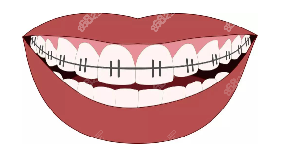 广州番禺牙齿正畸好的医院十家名单你参考