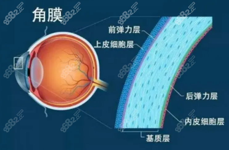 爱尔眼科近视眼手术