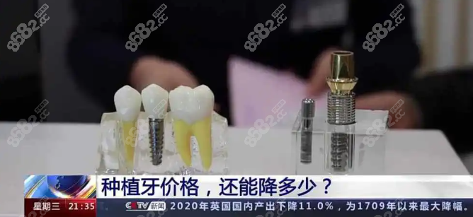 种植牙集采政策解读8682.cc