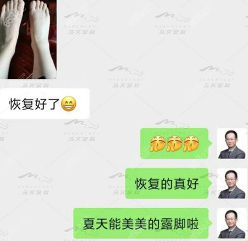 <!--<i data=20240705-sp></i>-->大脚骨手术术后评价 <!--<i data=20240705-sp></i>-->大脚骨手术术后评价